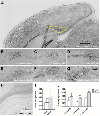Sex differences in hippocampal β-amyloid accumulation in the triple-transgenic mouse model of Alzheimer’s disease and the potential role of local estrogens